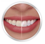 teeth