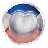 tooth protection